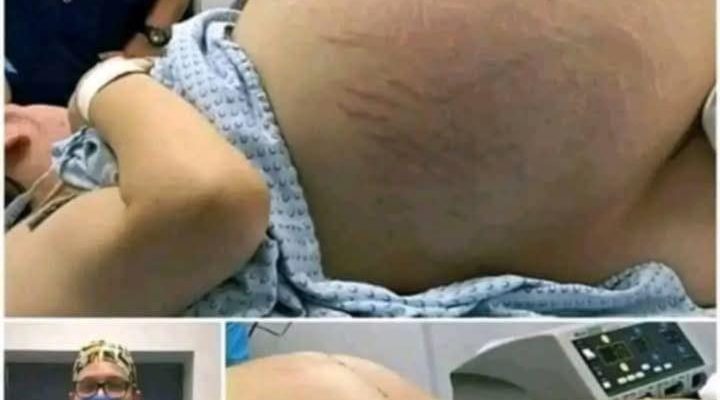 Understanding and Managing Those Painful Red Bumps