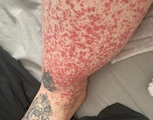 These are the consequences of sleeping with…See more